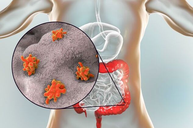 typy parazitov v ľudskom tele